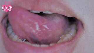 口中撮影 口中撮影